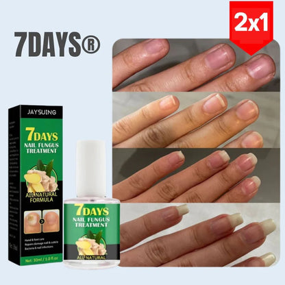 SERUM DE UÑAS X7